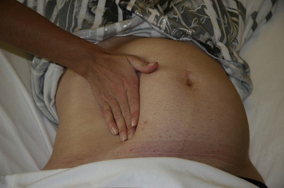 left uterine displacement from right side