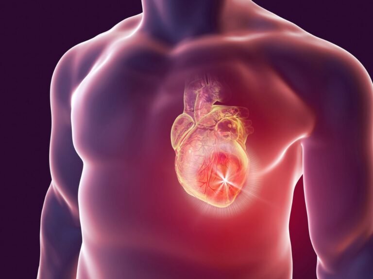 understanding acute coronary syndrome algo